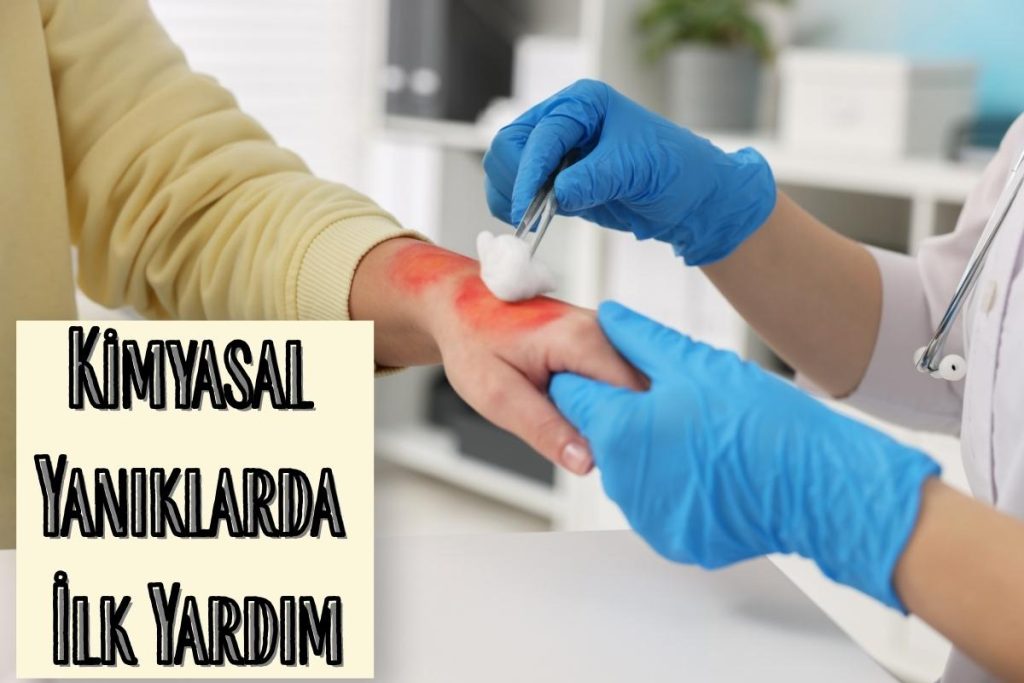 Kimyasal Yanıklarda İlk Yardım