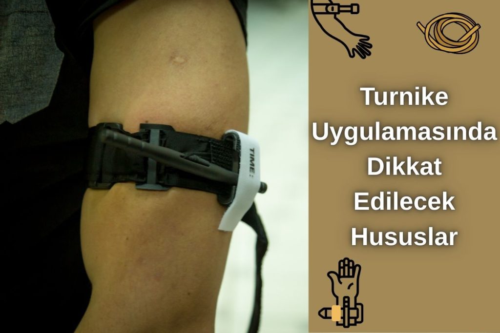 Turnike Uygulamasında Dikkat Edilecek Hususlar